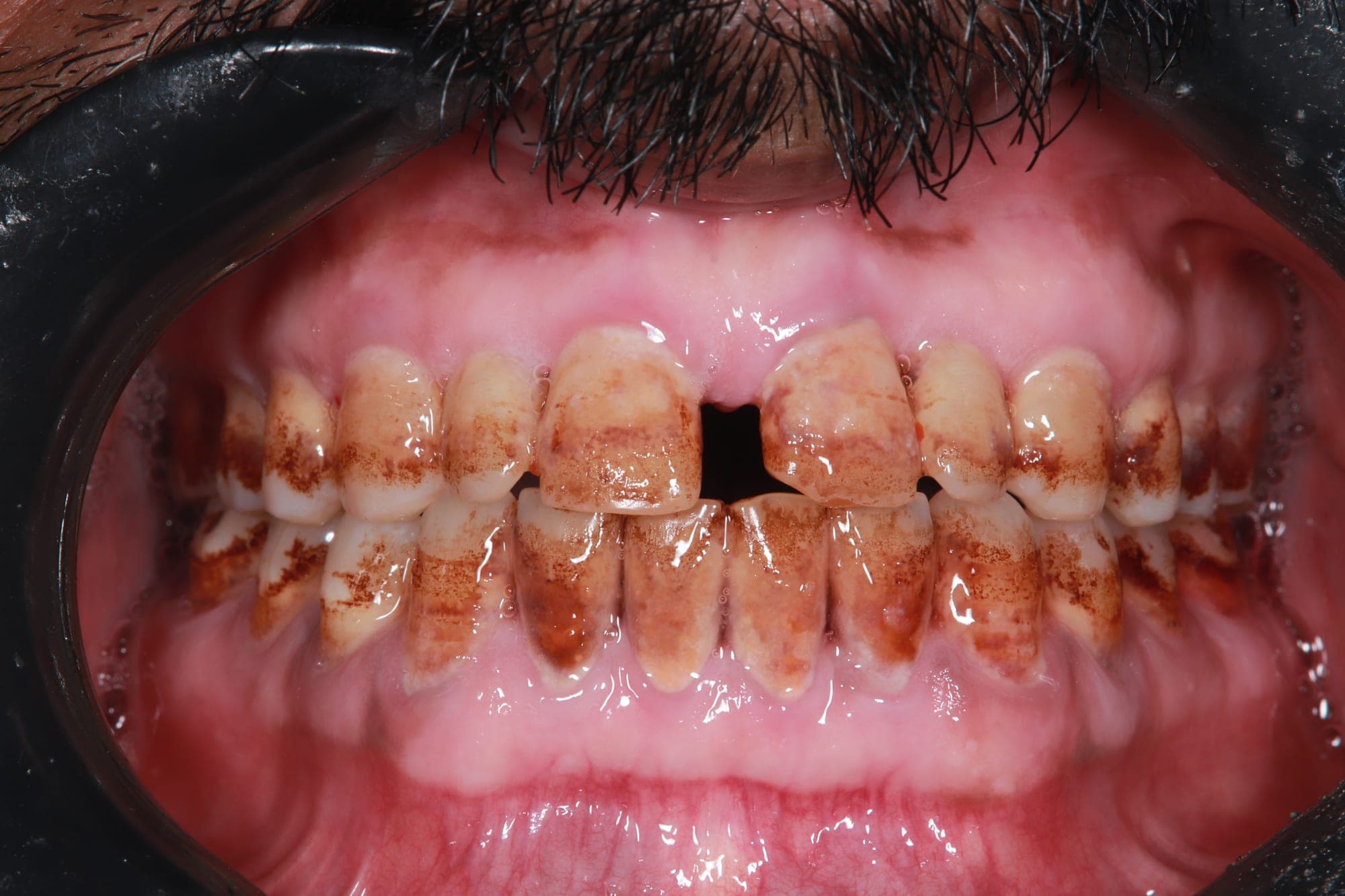 Premium Cosmetic Transformation — before treatment
