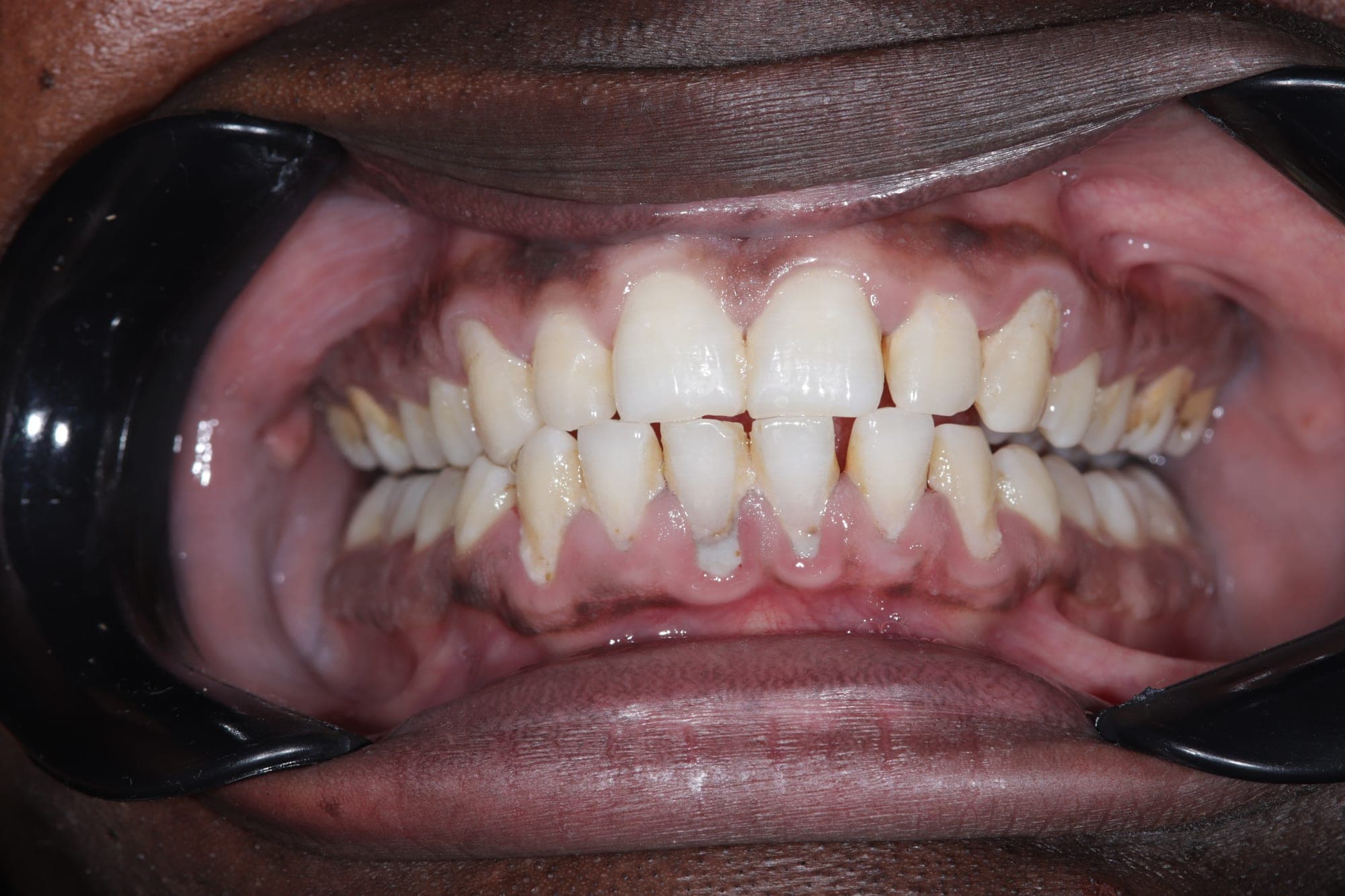 Premium Cosmetic Transformation — before treatment