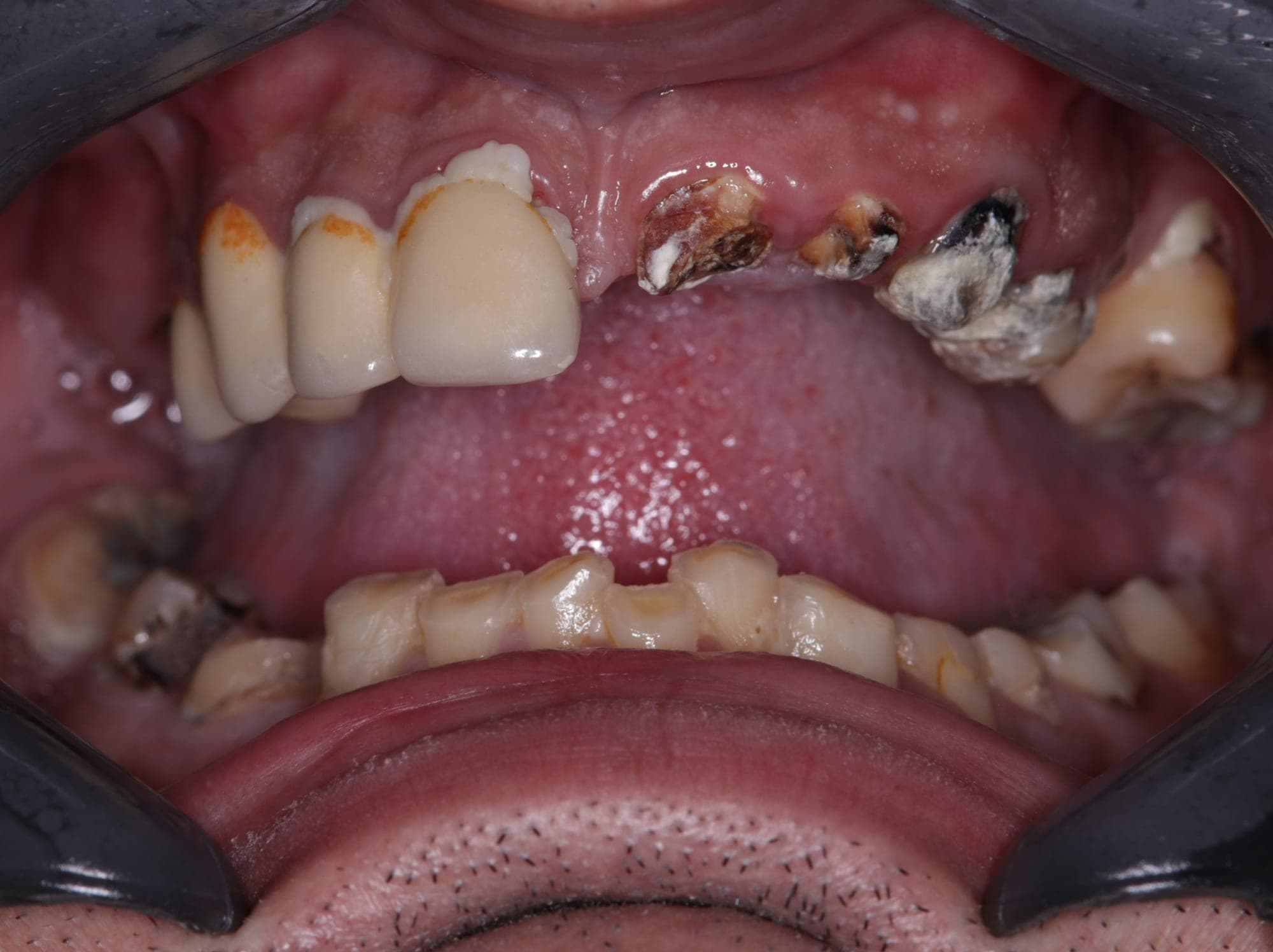 Premium Cosmetic Transformation — before treatment