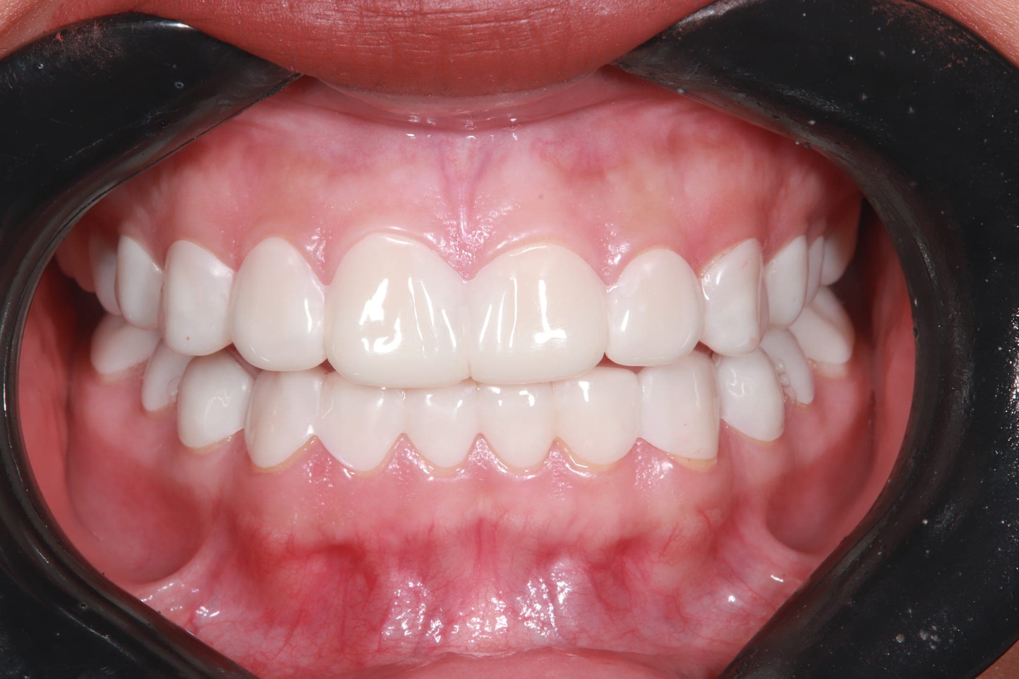Premium Cosmetic Transformation — before treatment