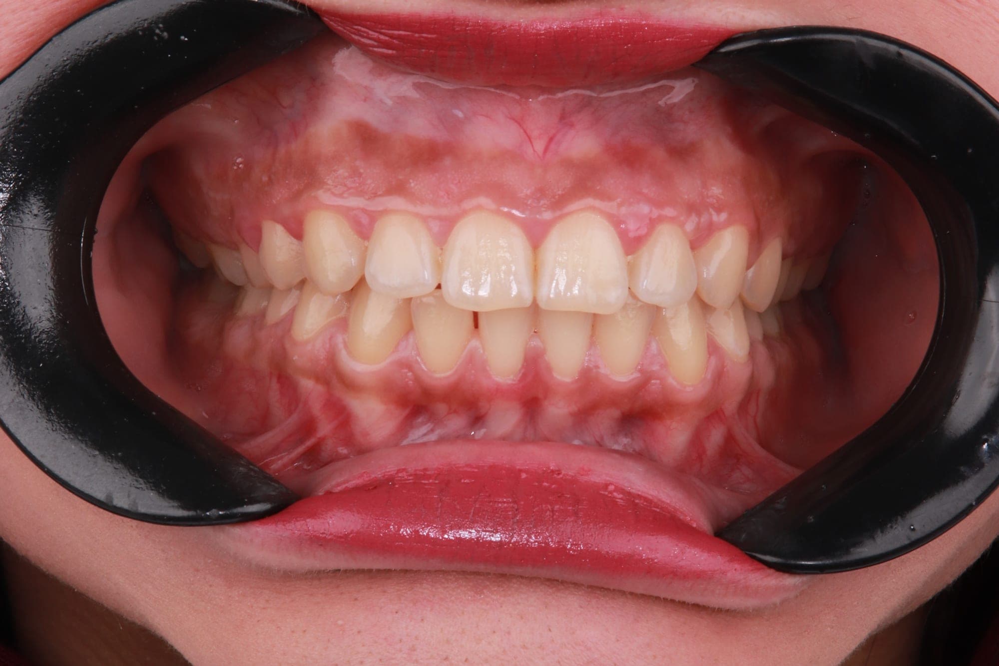 Premium Cosmetic Transformation — before treatment