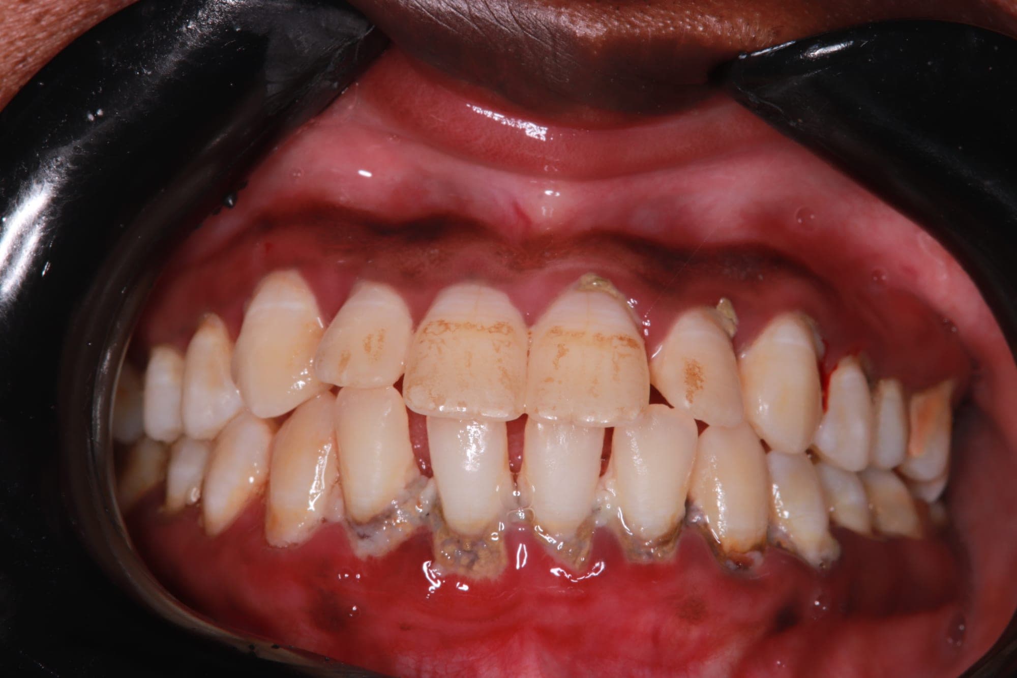 Premium Cosmetic Transformation — before treatment