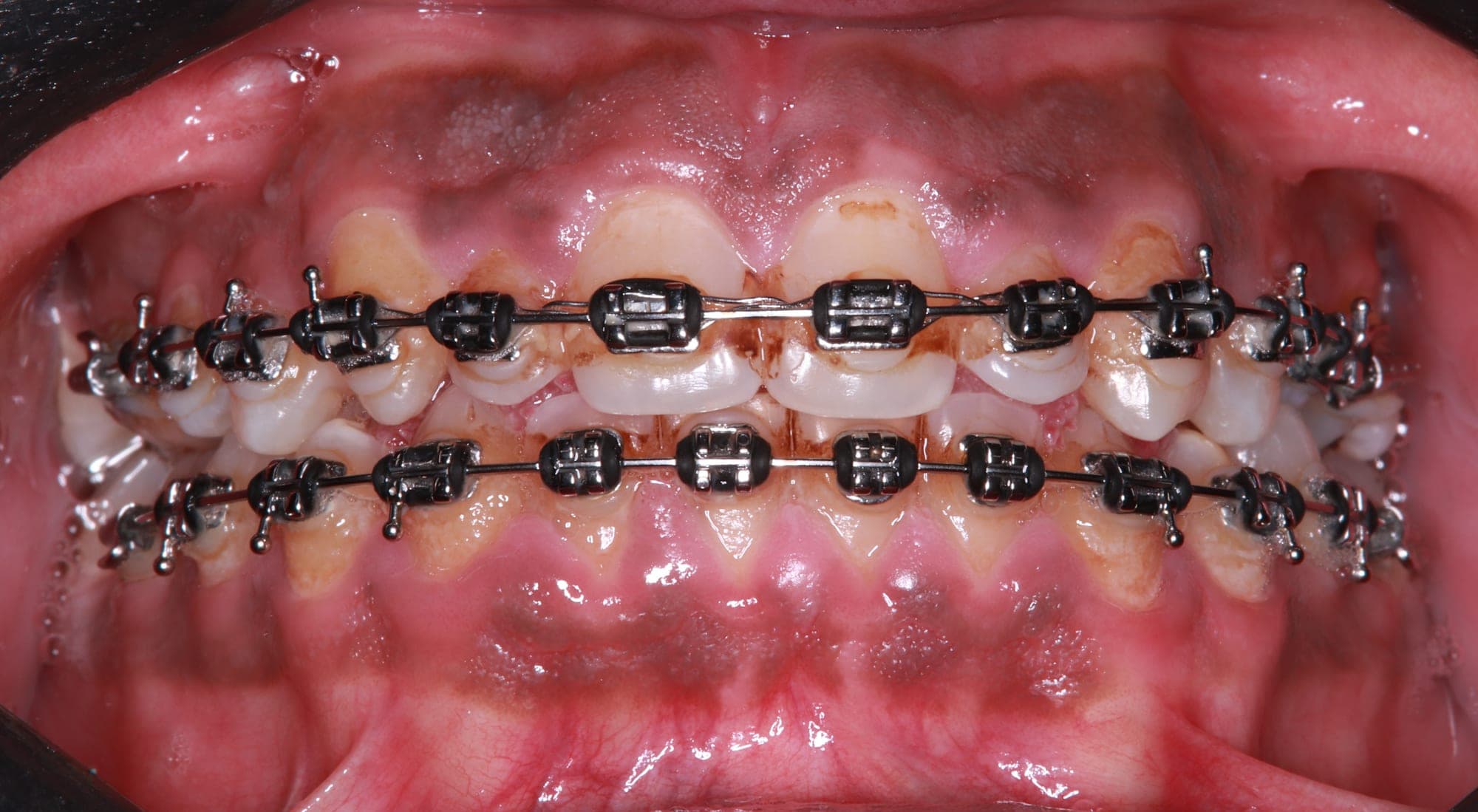 Premium Cosmetic Transformation — before treatment