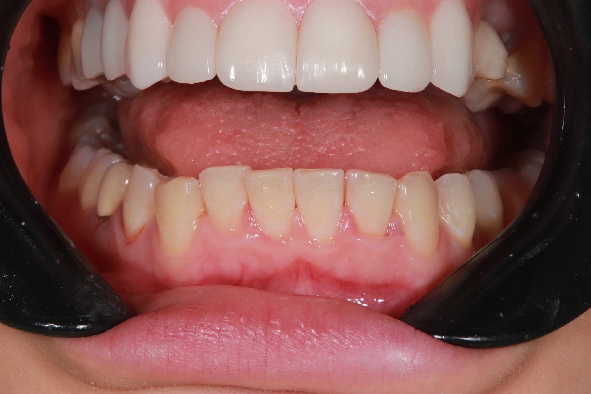 Premium Cosmetic Transformation — before treatment