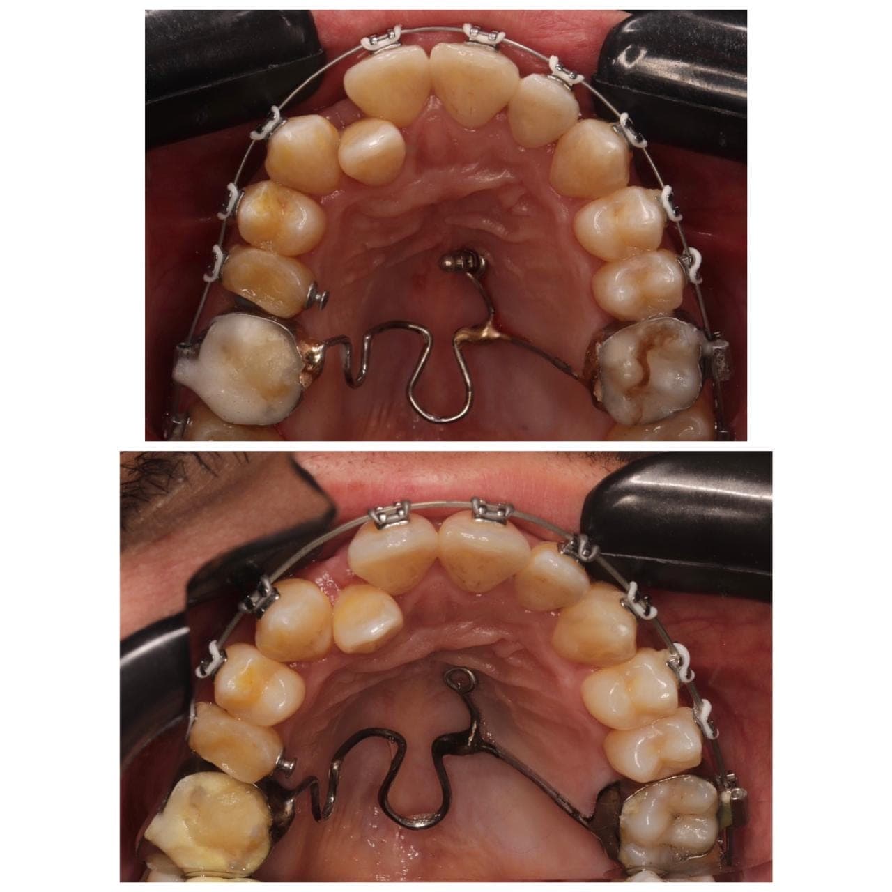 Premium Orthodontics Transformation — before