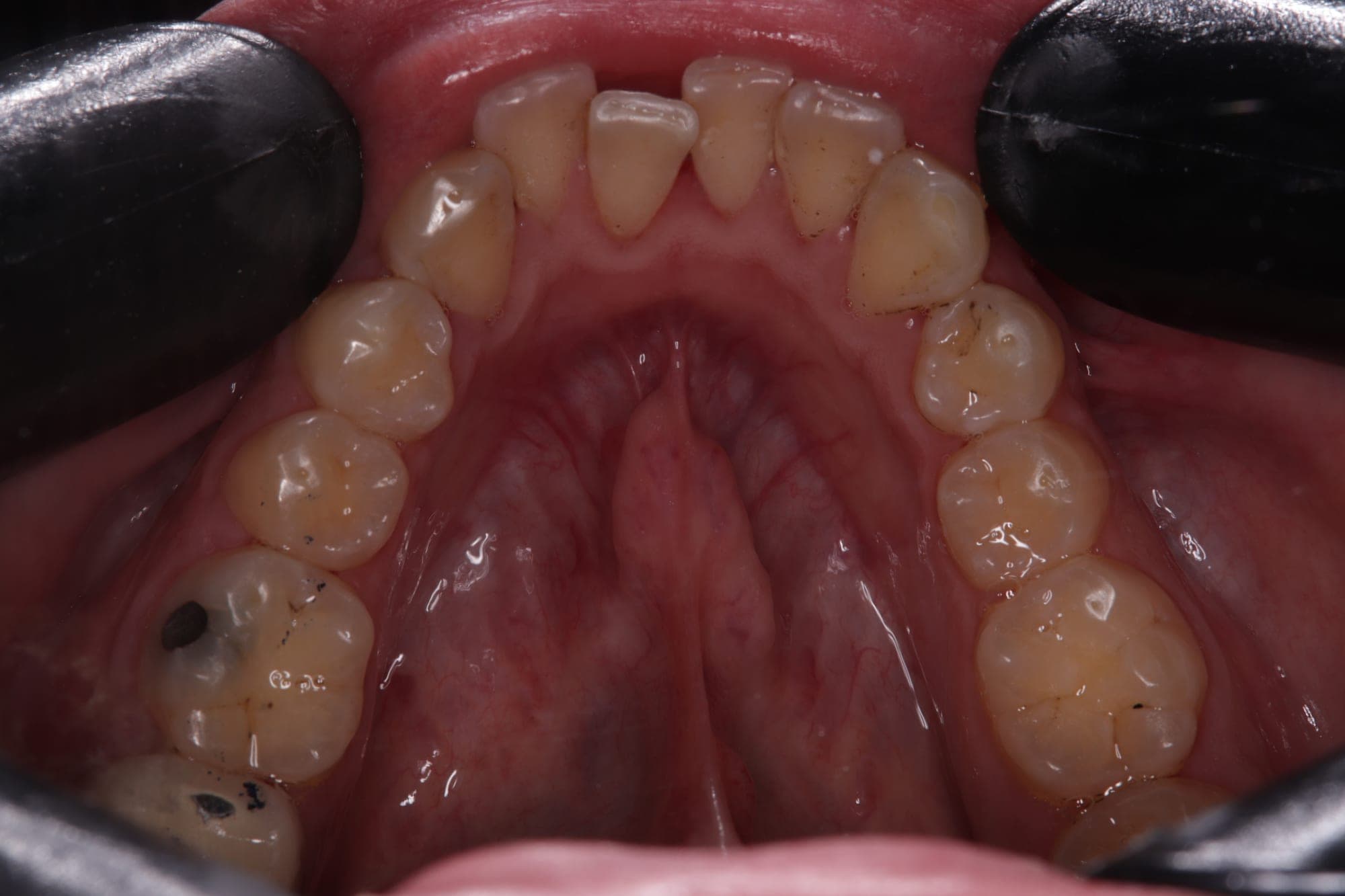 Premium Orthodontics Transformation — before