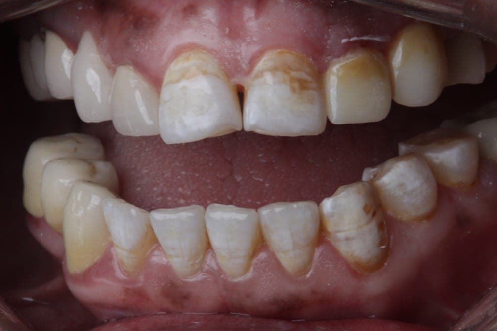 Premium Cosmetic Transformation — after treatment