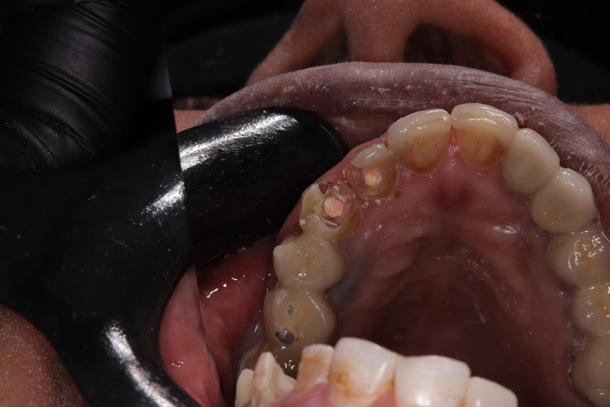 Premium Cosmetic Transformation — before treatment
