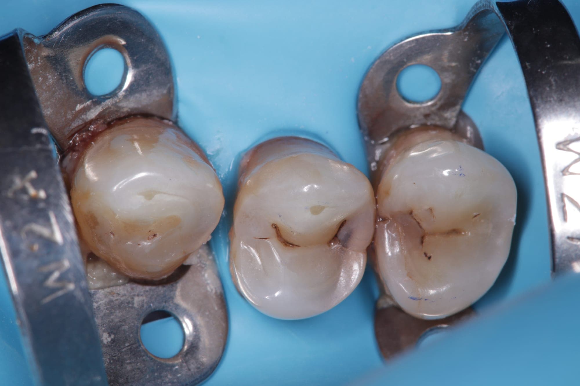 Premium Cosmetic Transformation — before treatment