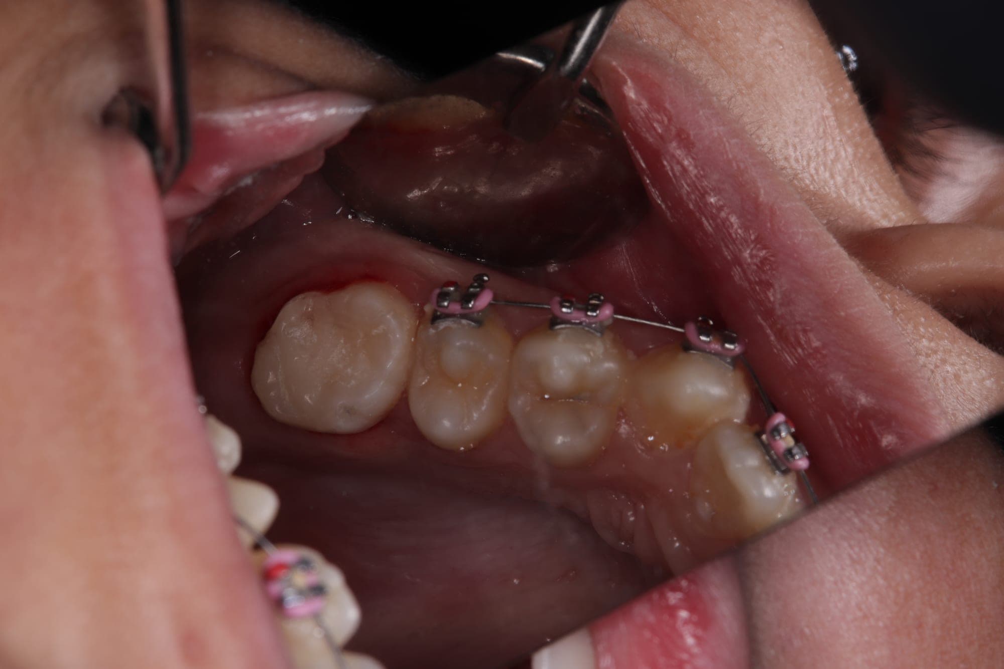 Premium Cosmetic Transformation — after treatment