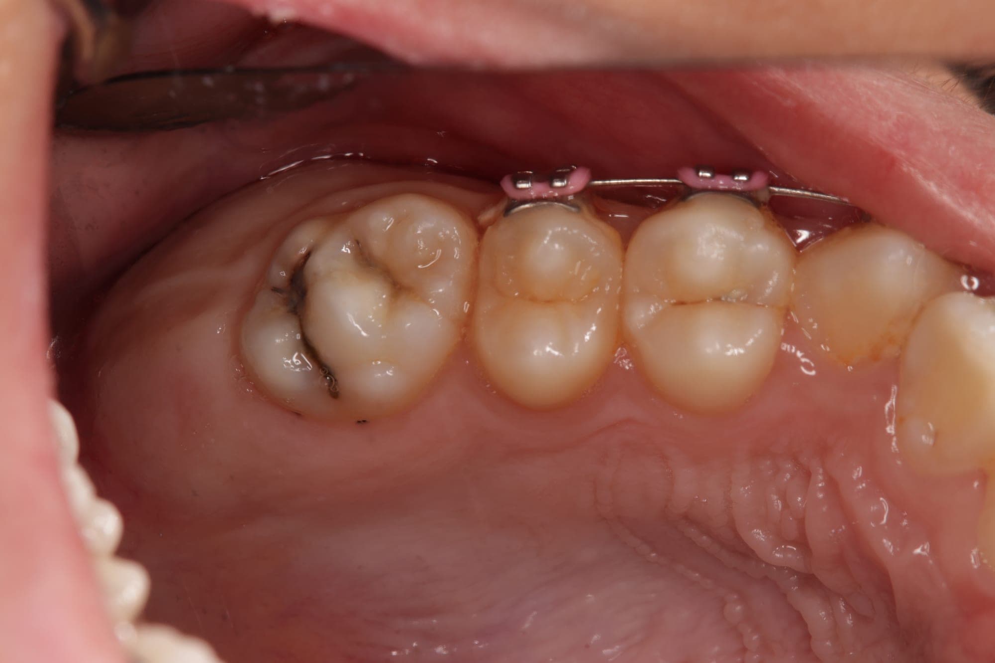Premium Cosmetic Transformation — before treatment