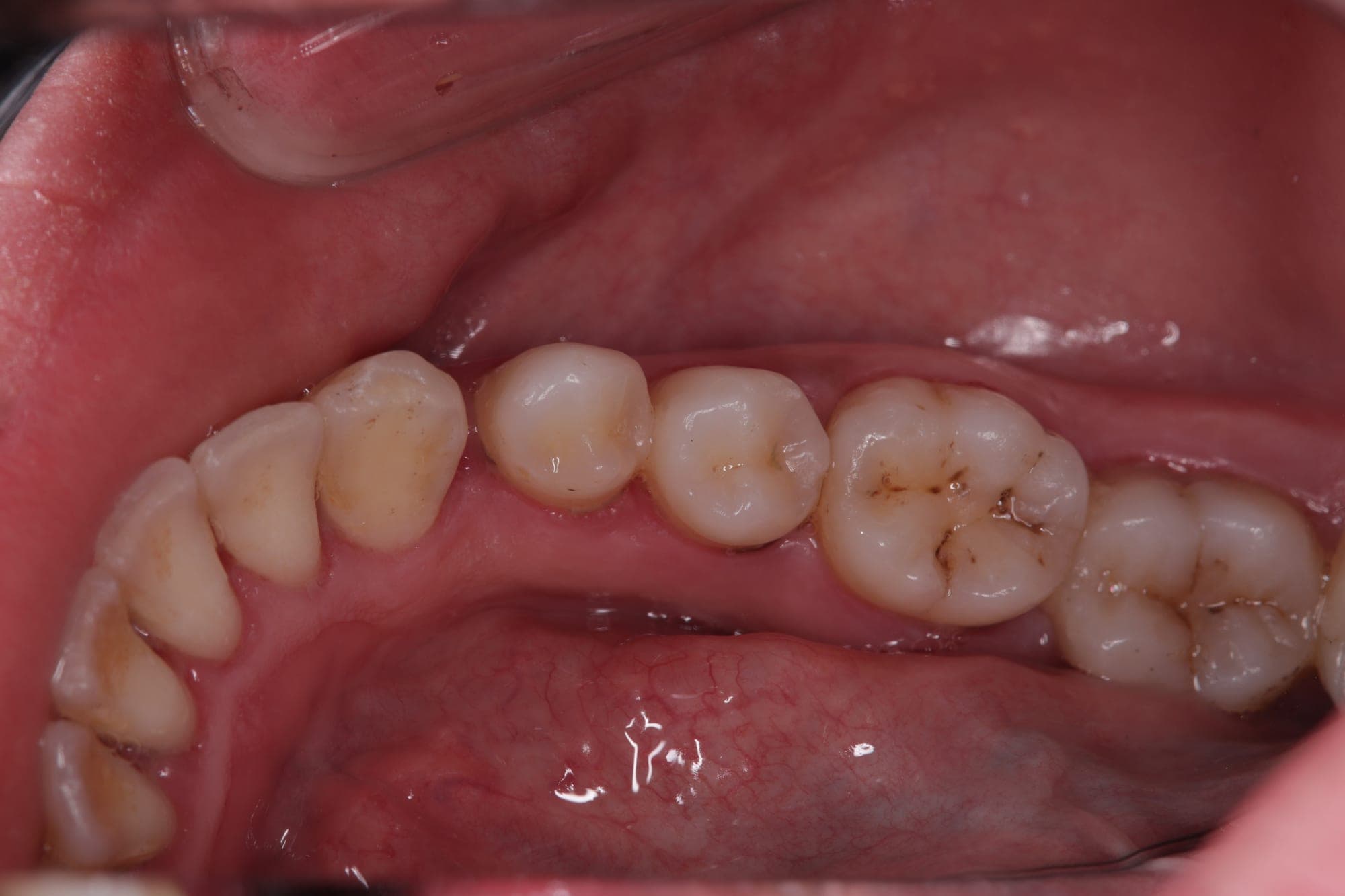 Premium Cosmetic Transformation — before treatment