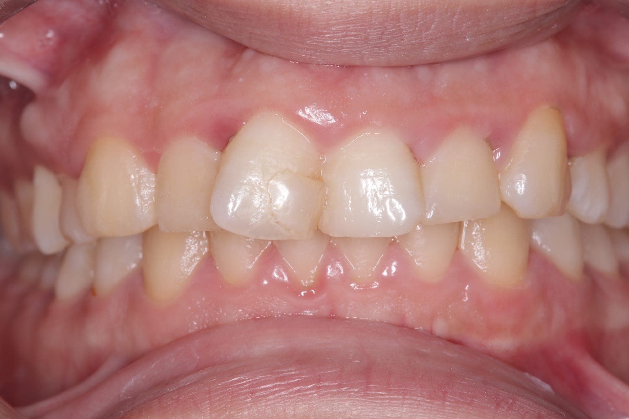 Premium Cosmetic Transformation — before treatment