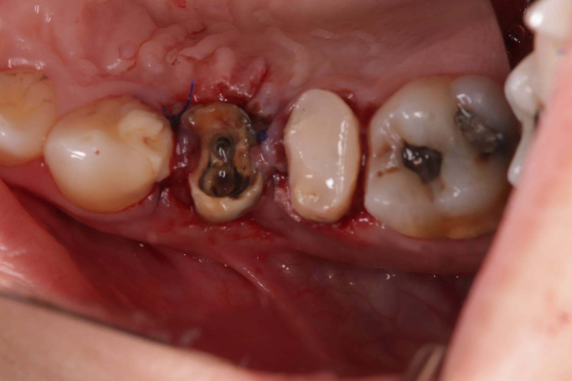 Premium Cosmetic Transformation — before treatment