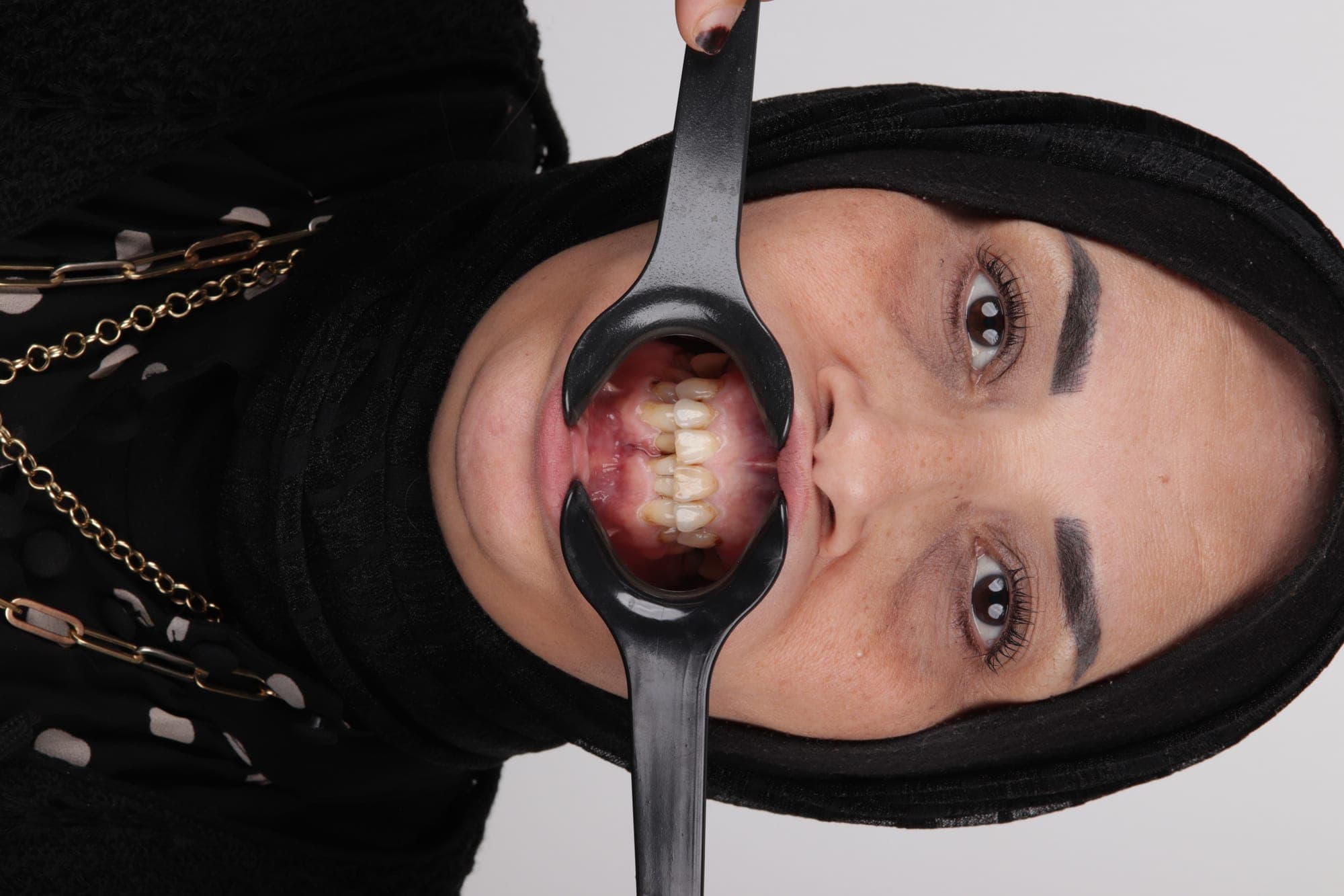 Premium Cosmetic Transformation — before treatment