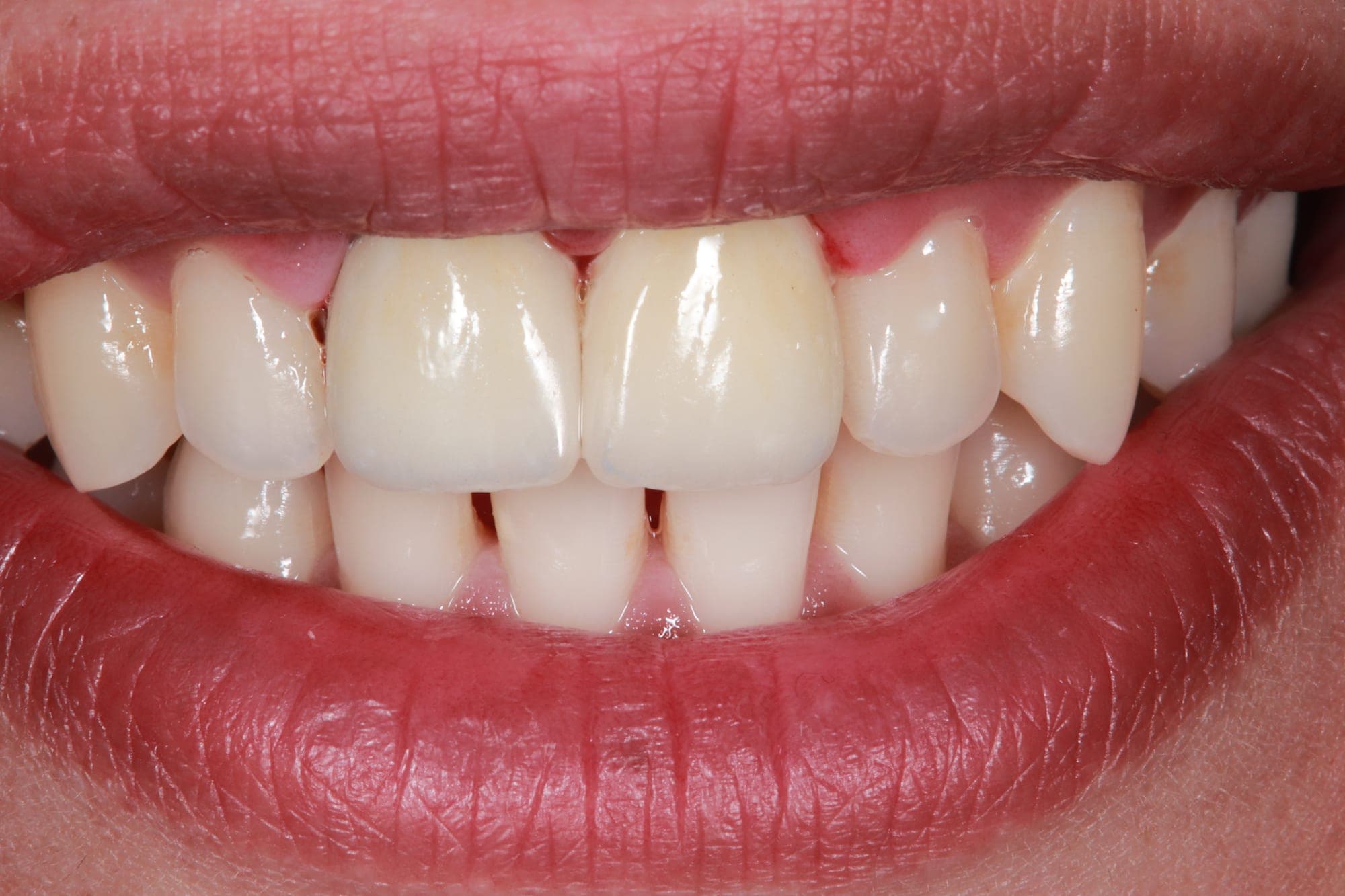 Premium Cosmetic Transformation — after treatment