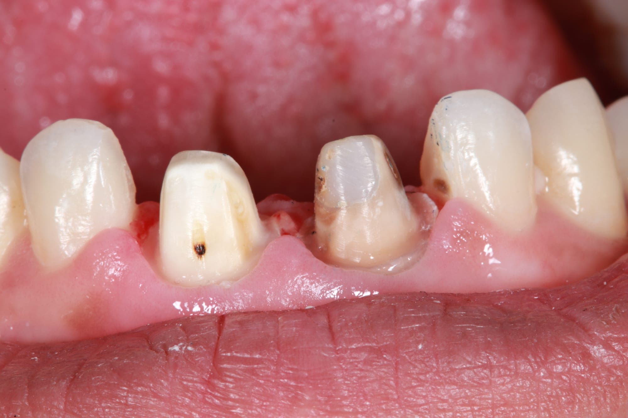 Premium Cosmetic Transformation — before treatment