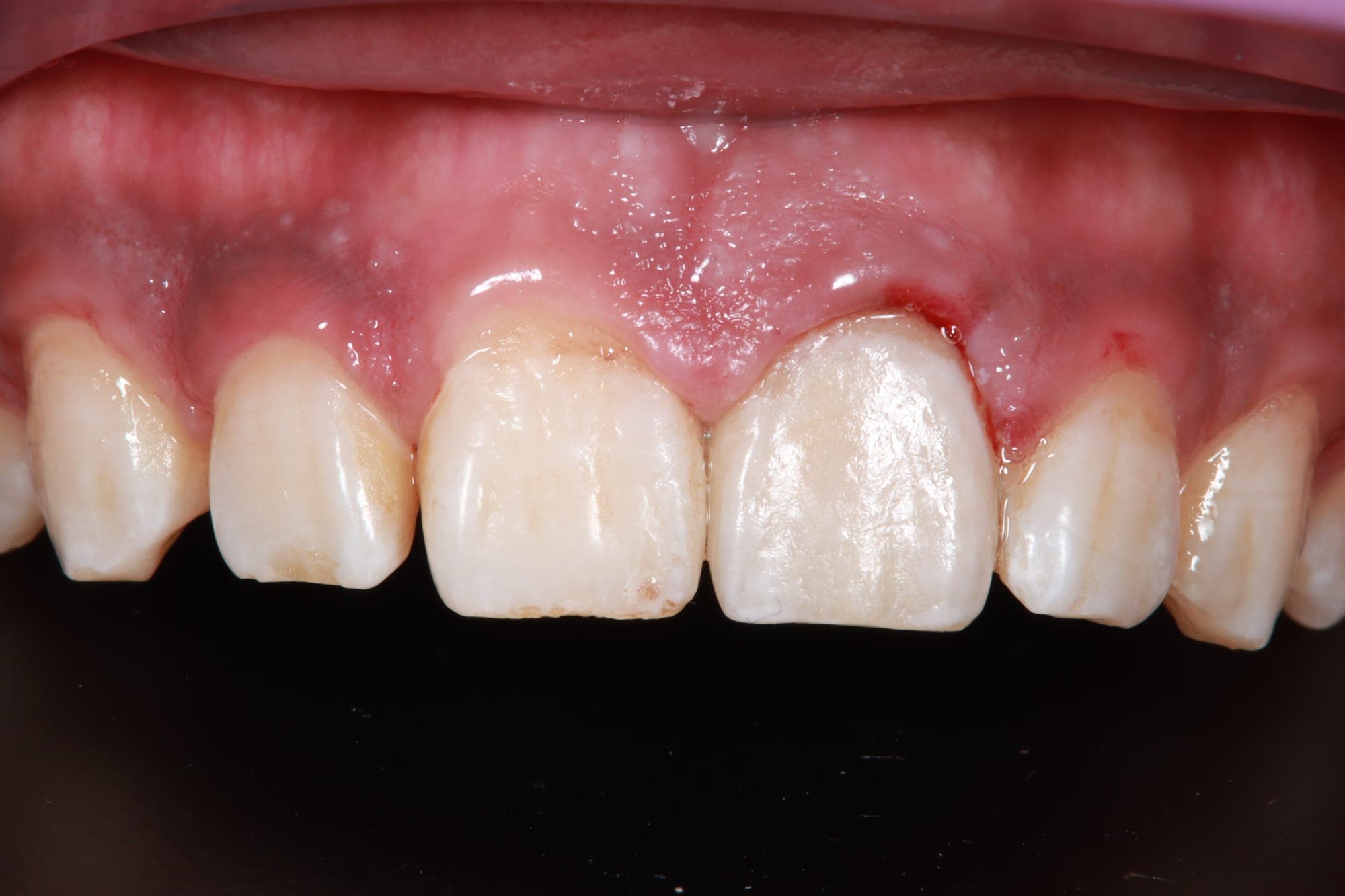 Premium Cosmetic Transformation — after treatment