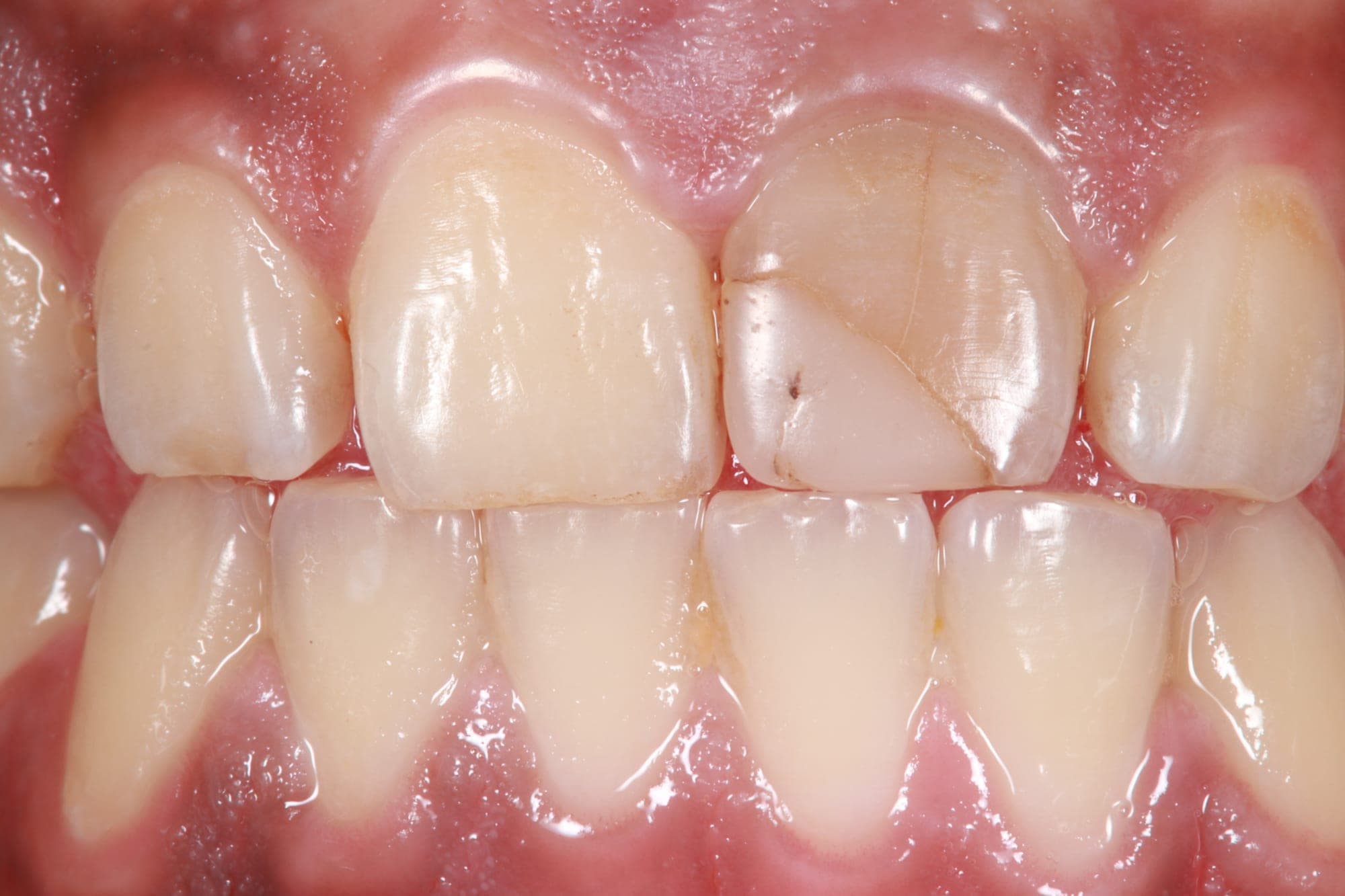 Premium Cosmetic Transformation — before treatment