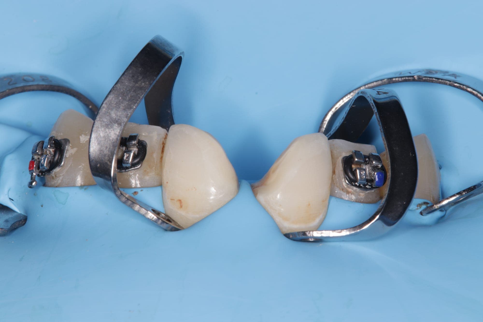 Premium Cosmetic Transformation — before treatment