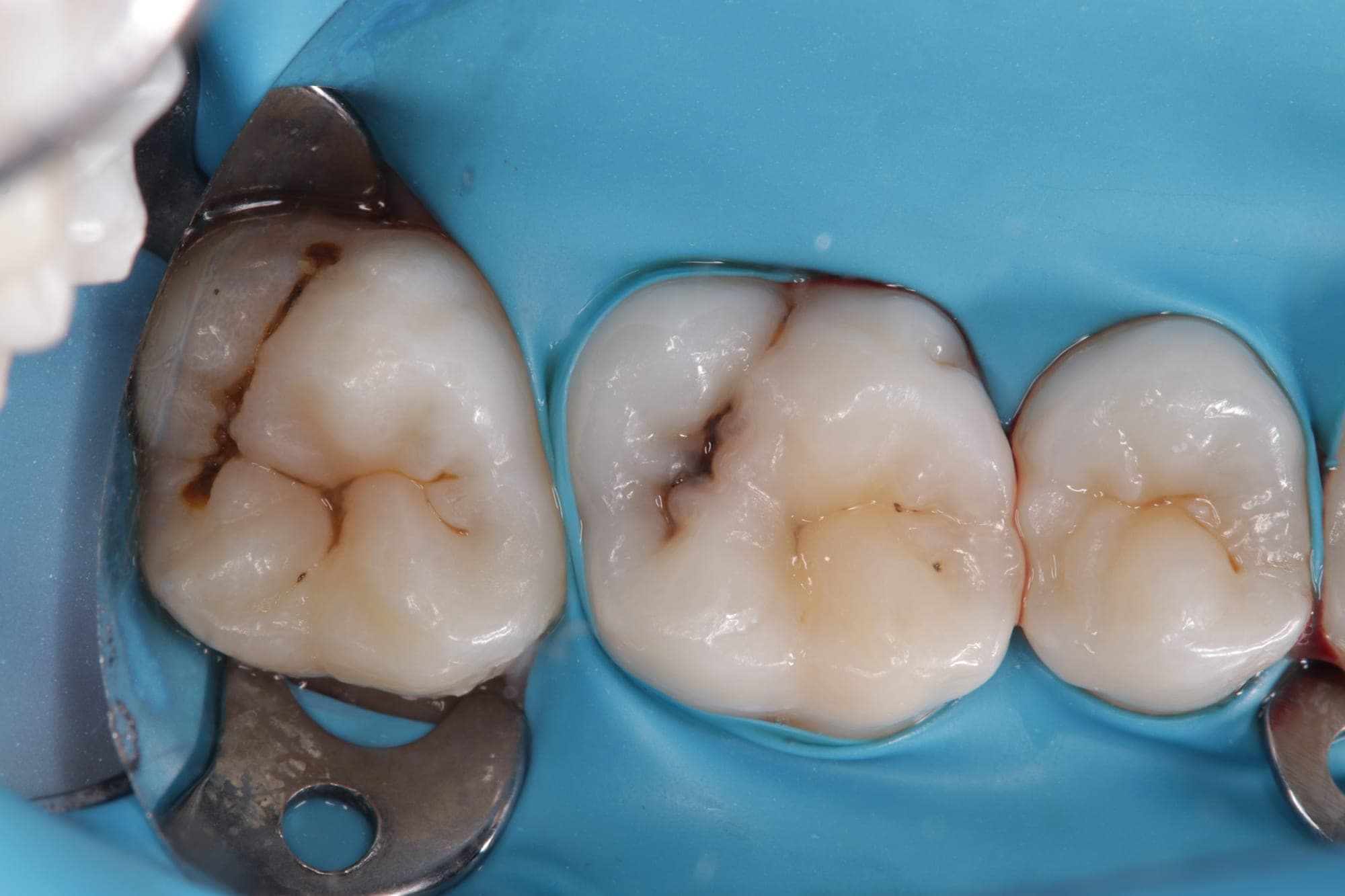 Premium Cosmetic Transformation — before treatment
