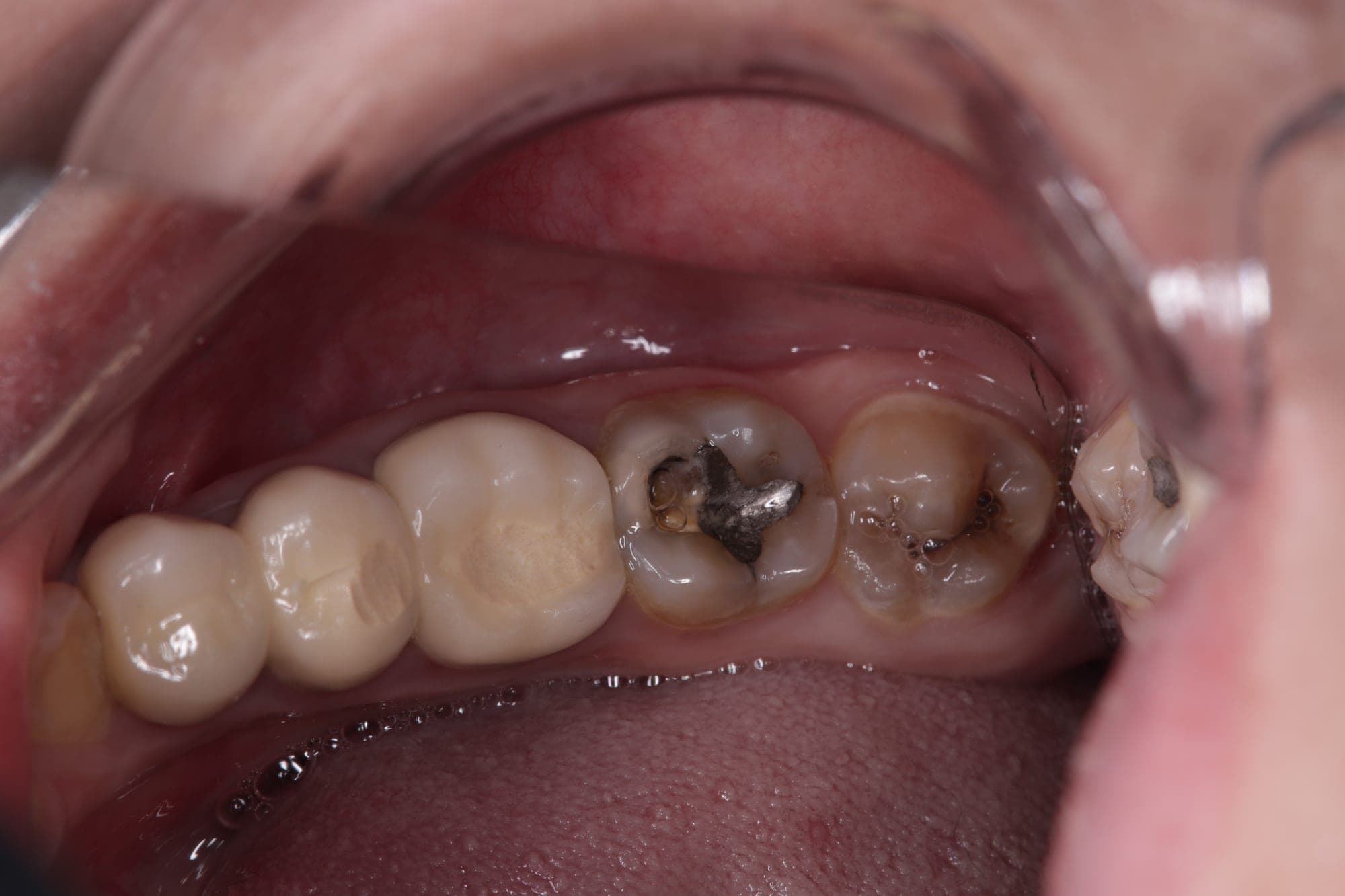 Premium Cosmetic Transformation — before treatment