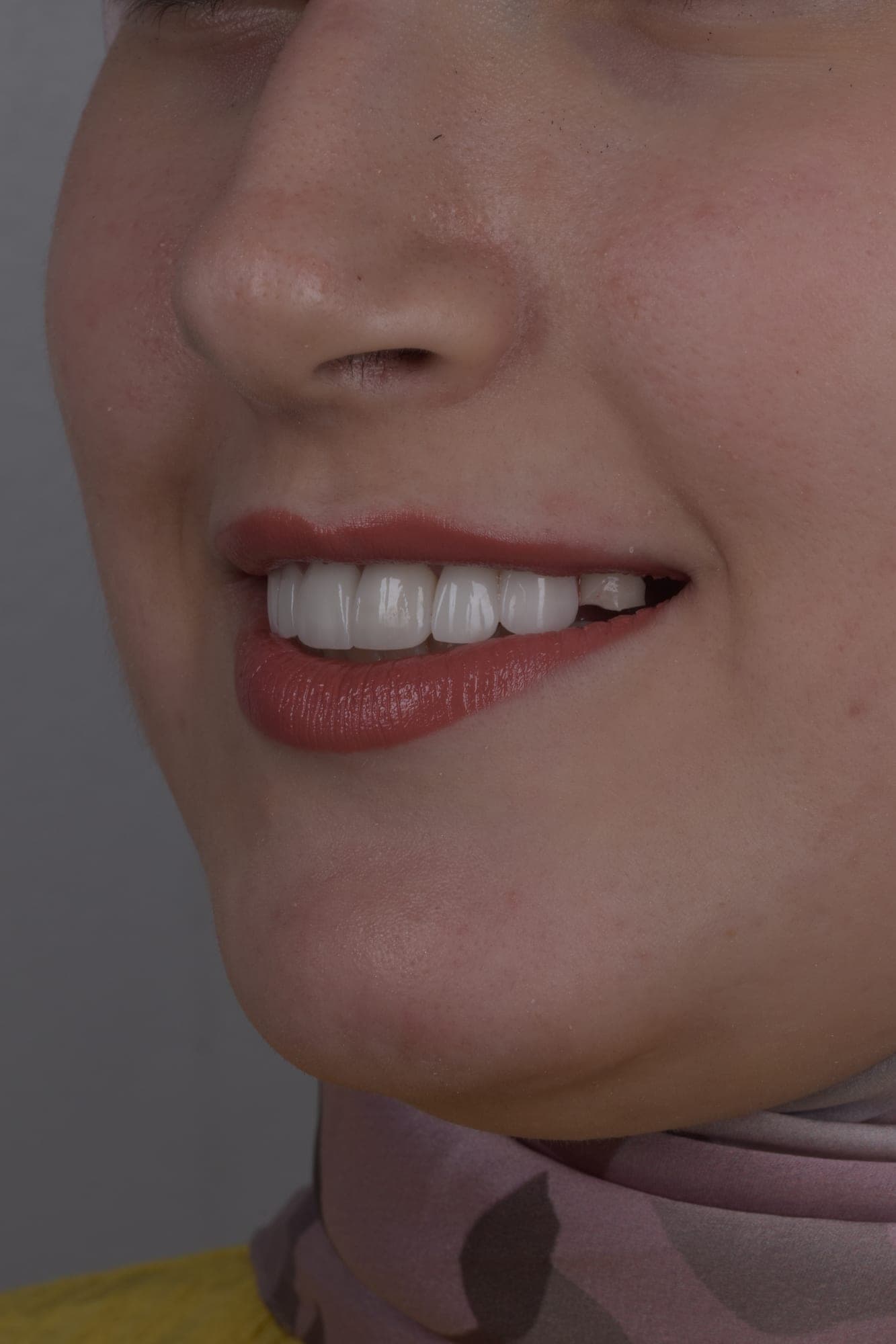 Premium Cosmetic Transformation — before treatment