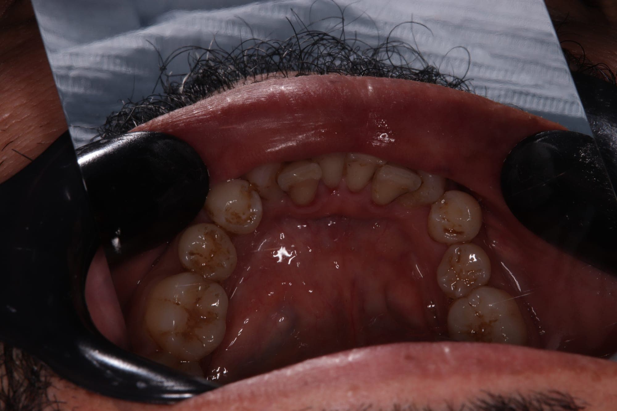 Premium Cosmetic Transformation — after treatment