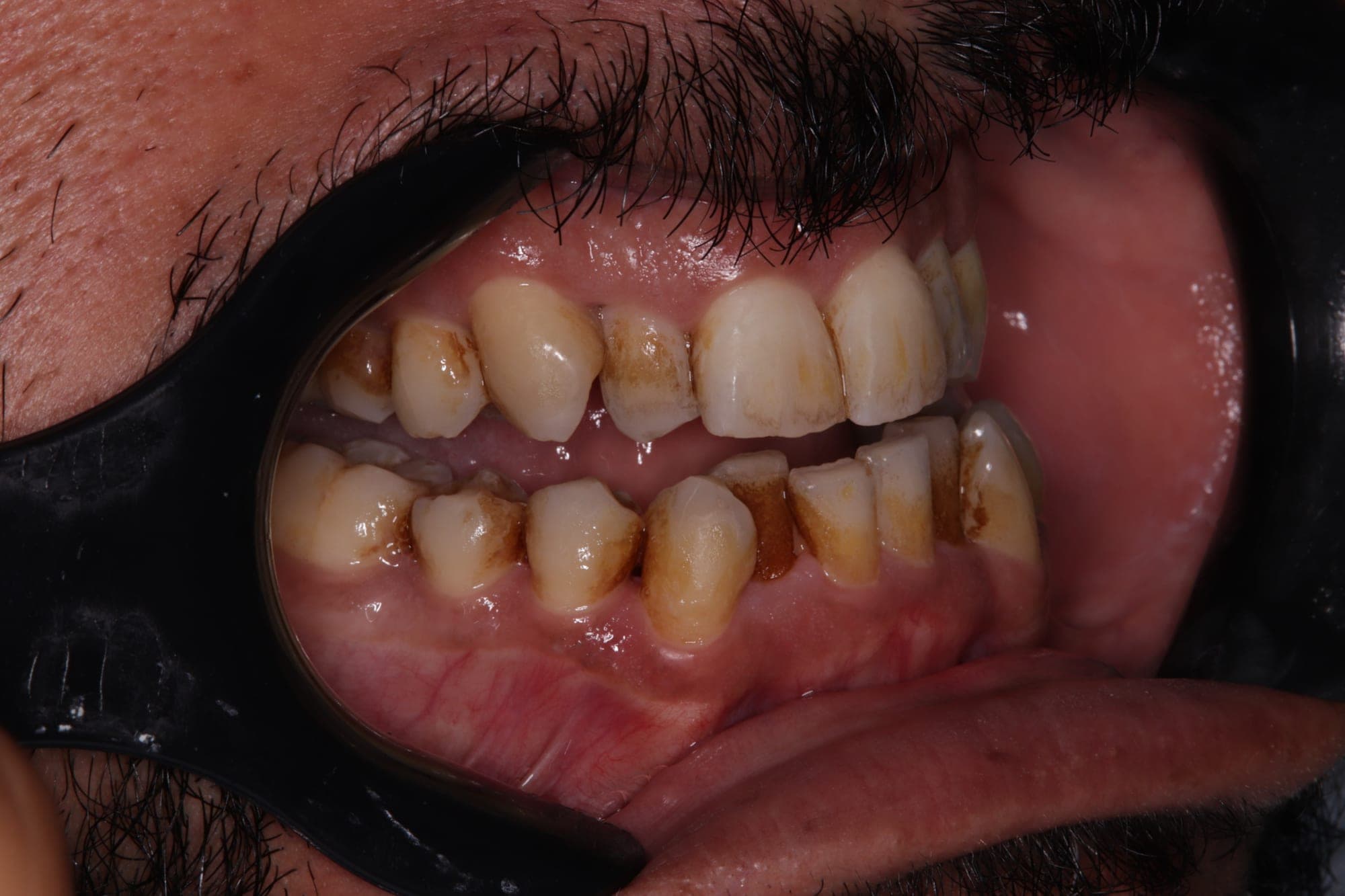 Premium Cosmetic Transformation — before treatment